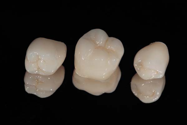 Dental Crown West Roxbury, MA