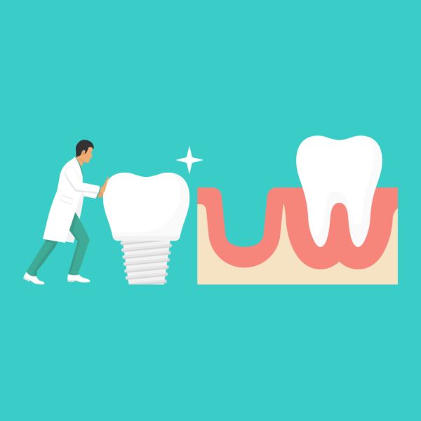 Dental Implants Professional West Roxbury, MA