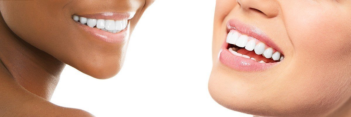 West Roxbury Dental Restoration