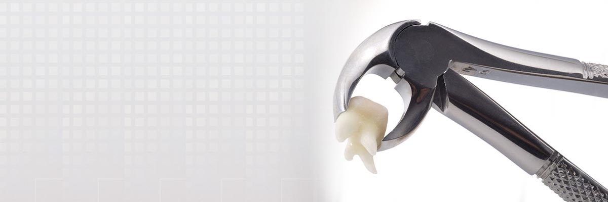 West Roxbury Tooth Extraction